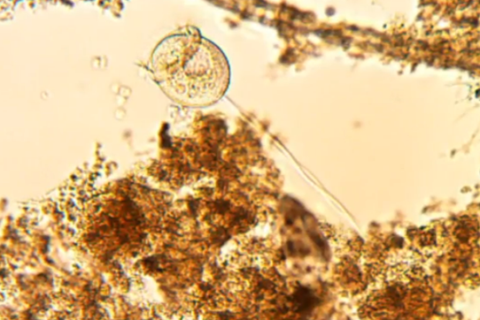 A closeup of a microscopic organism, with a round head and what looks to be a pointy crown with a long thin tail on the back end. 