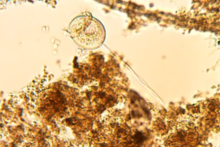 A closeup of a microscope organism, with what looks like a giant round head and a pointy crown and a long thin tail on the back end. 
